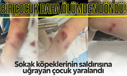 Rize'de sokak köpeklerinin saldırısına uğrayan çocuk yaralandı