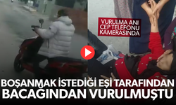 Boşanmak istediği eşi tarafından bacağından vuruldu