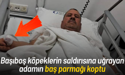 Başıboş köpeklerin saldırısına uğrayan adamın baş parmağı koptu