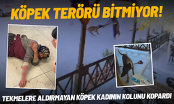 Köpek terörü bitmiyor! Tekmelere aldırmayan köpek kadının kolunu kopardı
