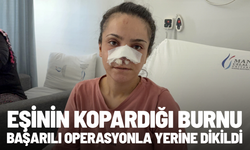 Eşinin kopardığı burnu başarılı operasyonla yerine dikildi