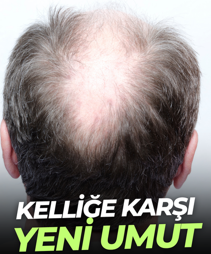 Kelliğe karşı yeni umut