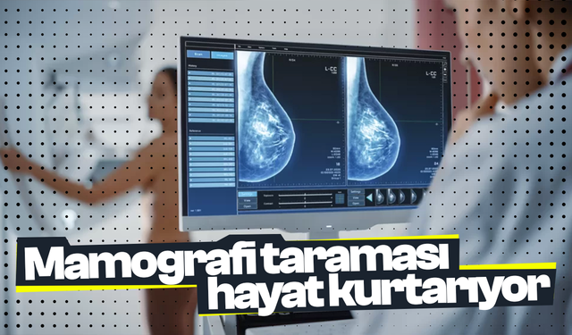 Mamografi taraması hayat kurtarıyor