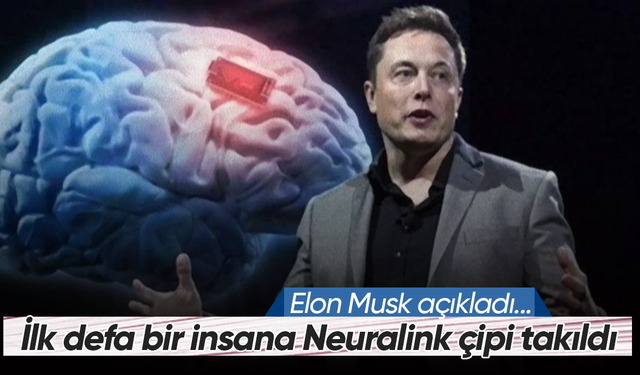 Elon Musk: “Neuralink'in beyin çipi ilk kez bir insana yerleştirildi”