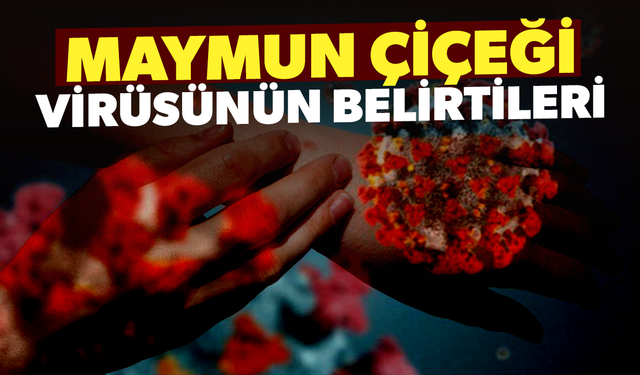 Halsizlik, baş ağrısı ve ateş; maymun çiçeği virüsünün belirtileri olabilir