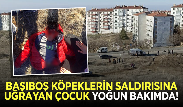 Okuldan dönerken başıboş köpeklerin saldırısına uğrayan çocuk yaşam savaşı veriyor!