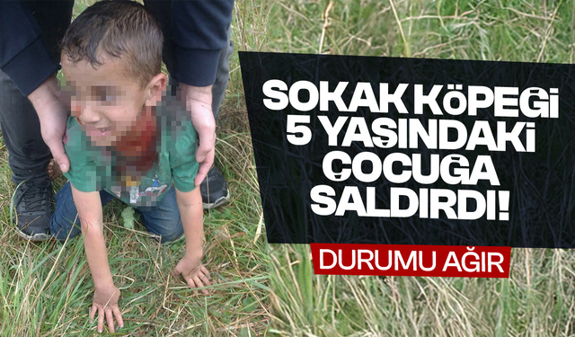 Sokak köpeği saldırısı: 5 yaşındaki çocuğun durumu ağır!