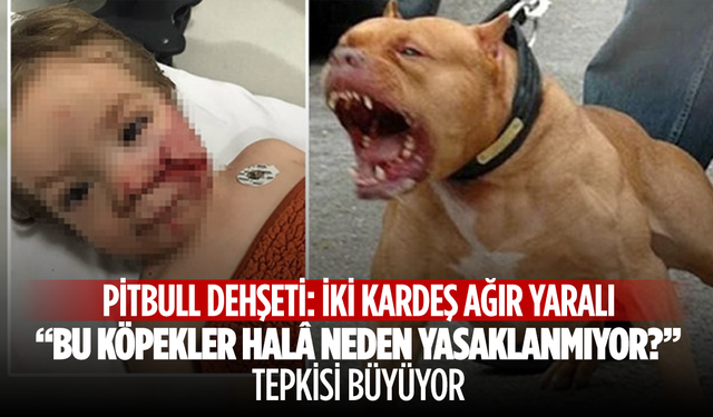 “Bu Köpekler Hâlâ Neden Yasaklanmıyor?” Tepkisi Büyüyor