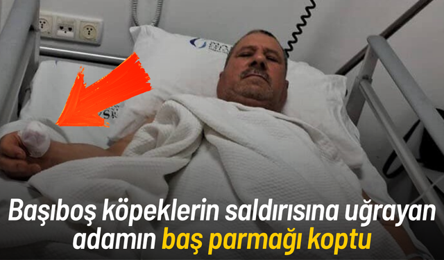 Başıboş köpeklerin saldırısına uğrayan adamın baş parmağı koptu