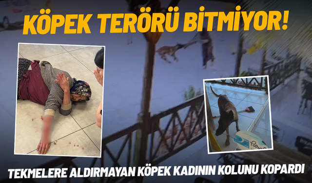 Köpek terörü bitmiyor! Tekmelere aldırmayan köpek kadının kolunu kopardı