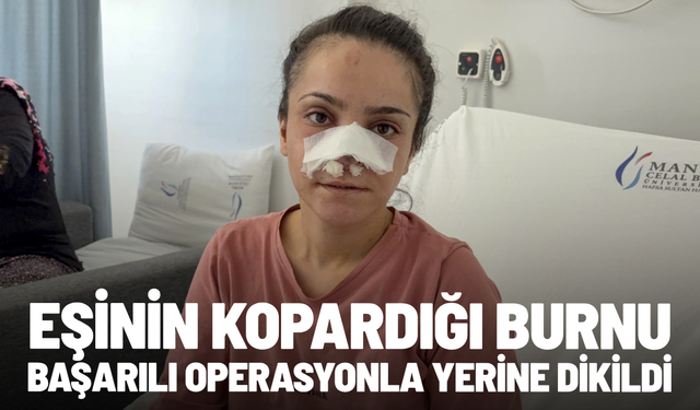 Eşinin kopardığı burnu başarılı operasyonla yerine dikildi