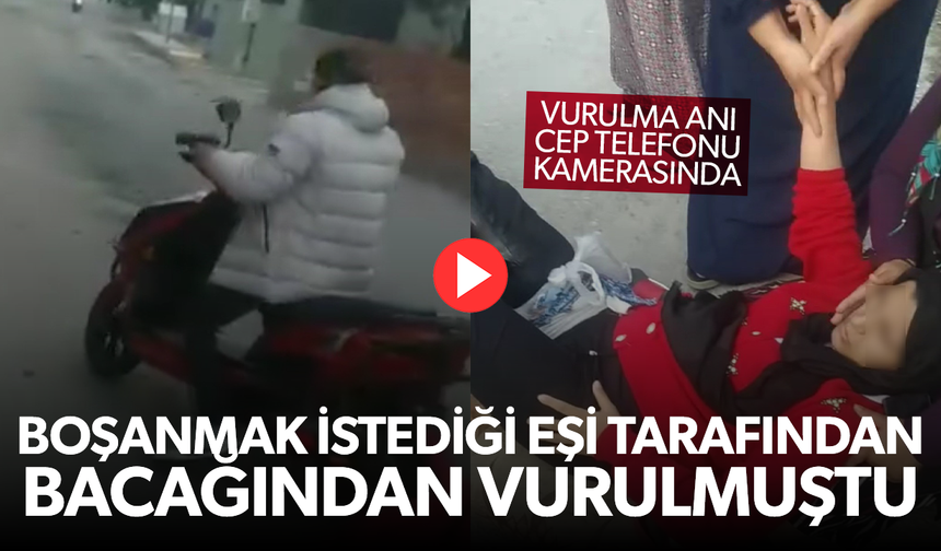 Boşanmak istediği eşi tarafından bacağından vuruldu