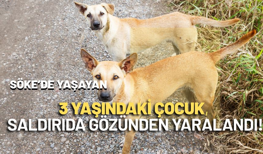 3 YAŞINDAKİ ÇOCUK SALDIRIDA GÖZÜNDEN YARALANDI!
