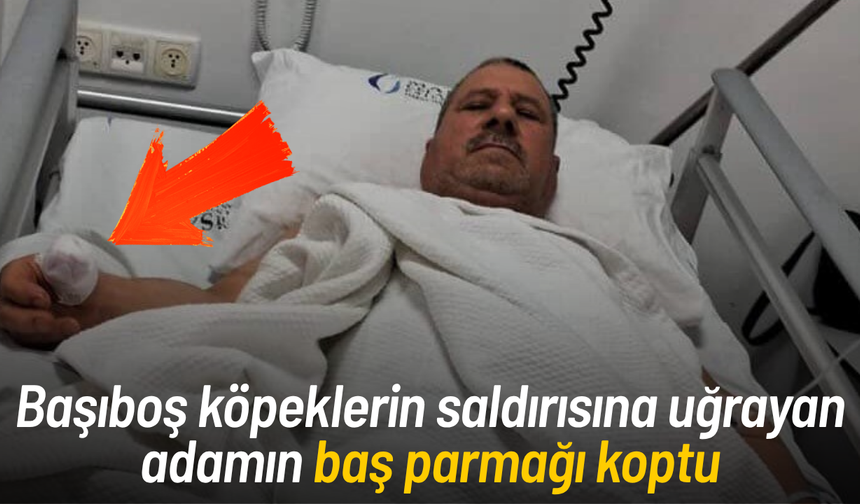 Başıboş köpeklerin saldırısına uğrayan adamın baş parmağı koptu
